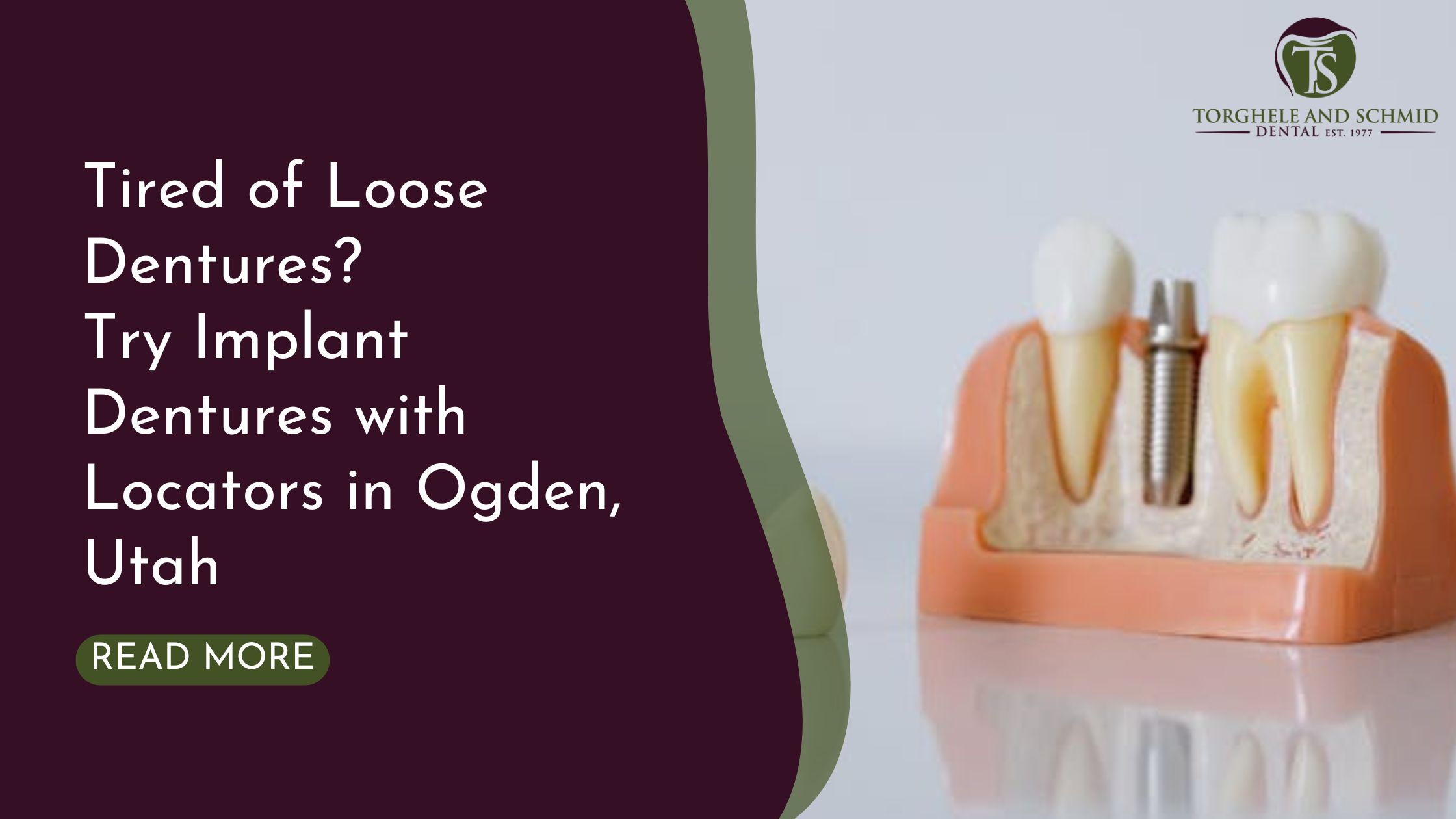 An anatomical model of teeth and a dental implant with the blog title and a "Read More" button.