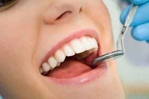Client's teeth being examined after dental filling in Ogden UT