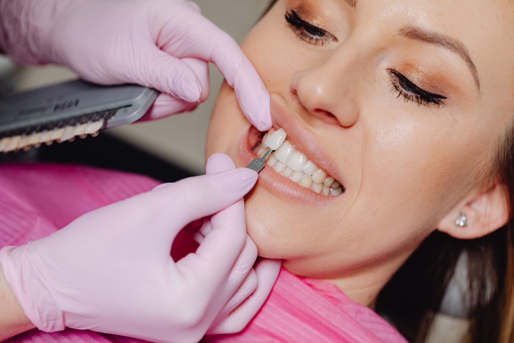 Dentist matching tooth shade tabs for a patient, exploring cosmetic dentistry options to transform a heavily damaged smile.